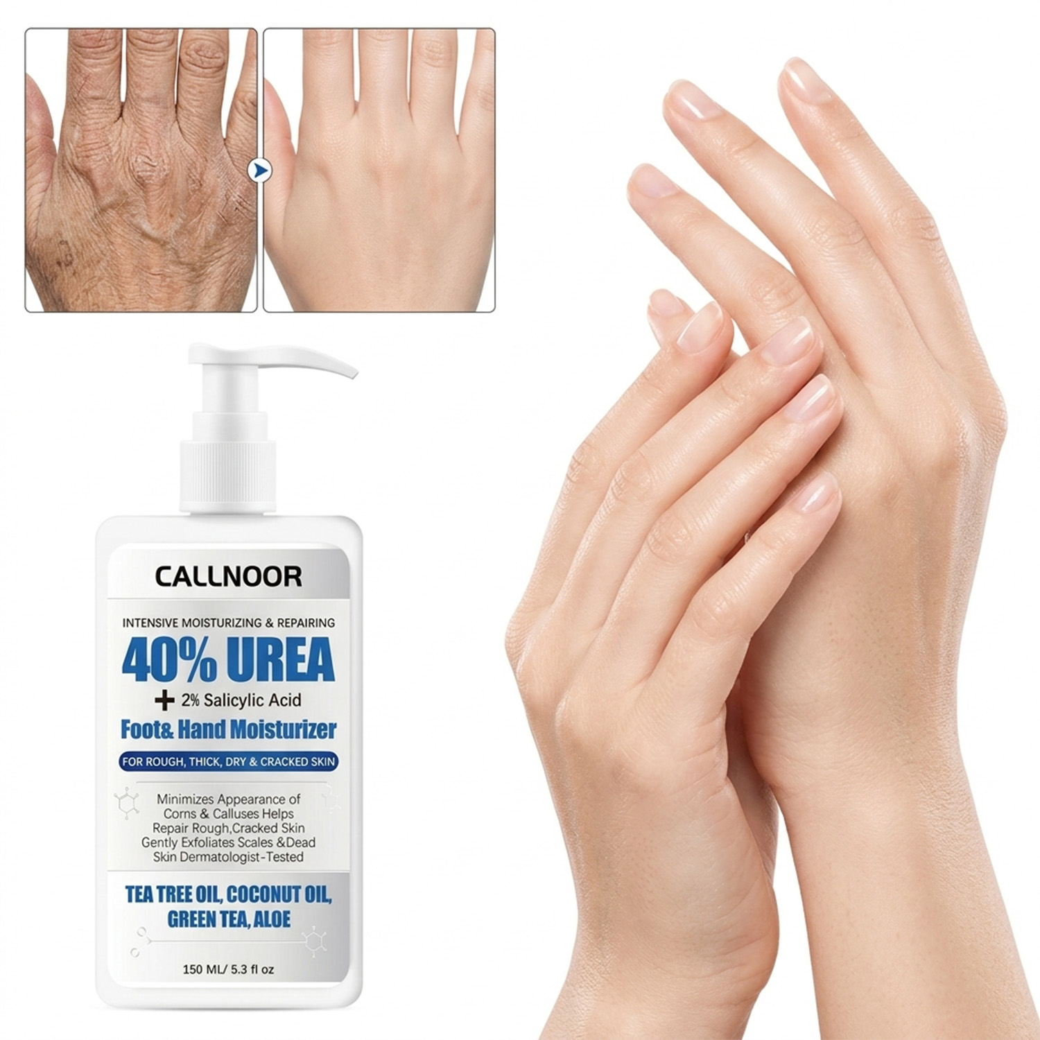 كريم لليدين والقدمين خالٍ من ا - مراجعة Urea Foot Cream وسعره