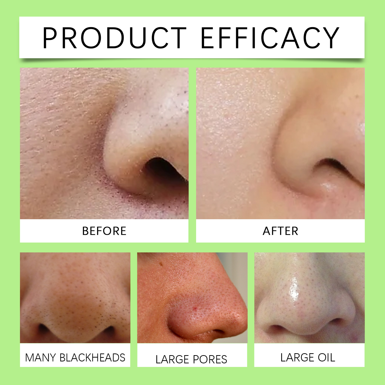 شرائح الفحم النباتي للأنف لإزا - مراجعة Cleanser Face وسعره